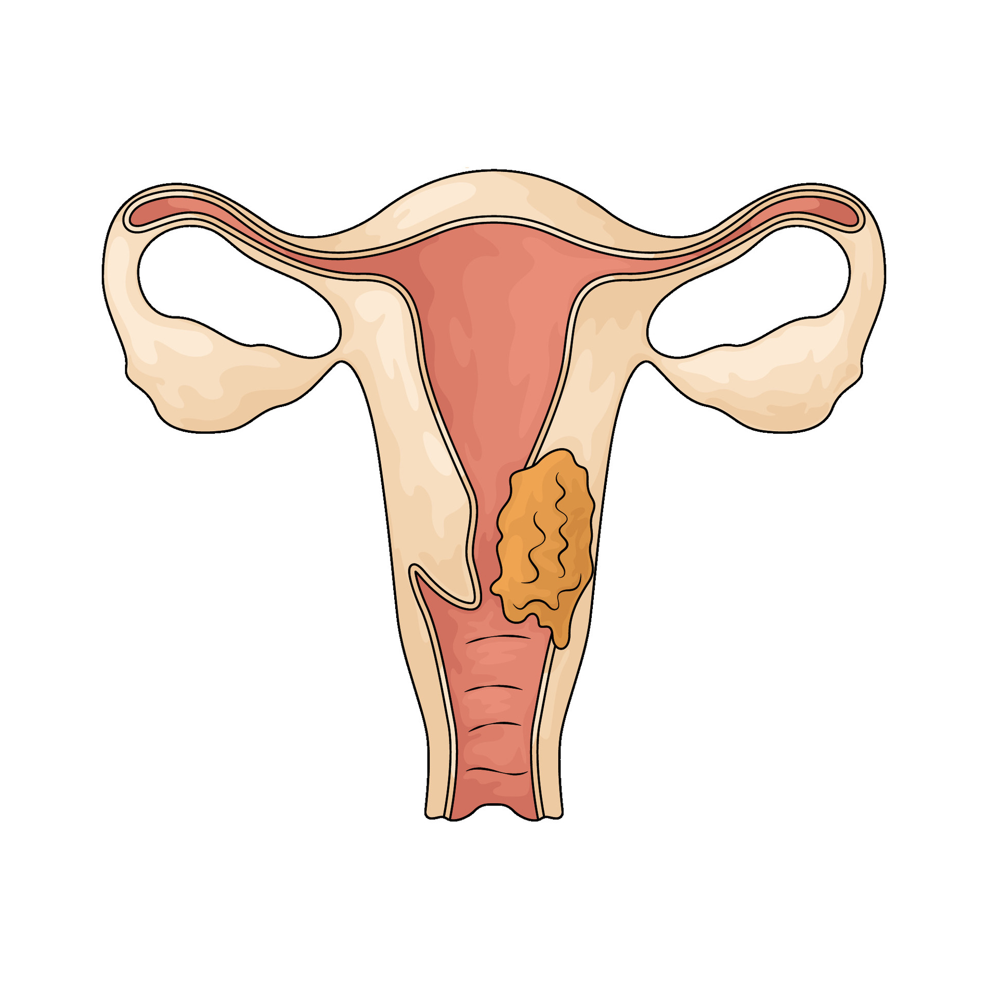 surgical-oncologist-in-lucknow